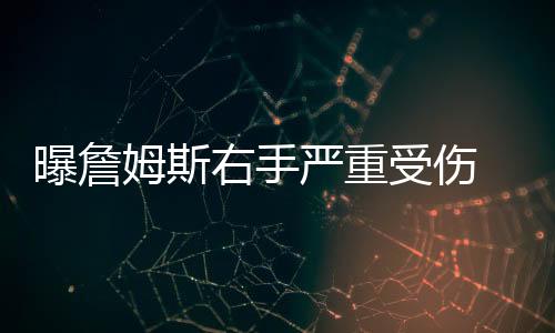 曝詹姆斯右手严重受伤 因G1后怒砸黑板致重受伤